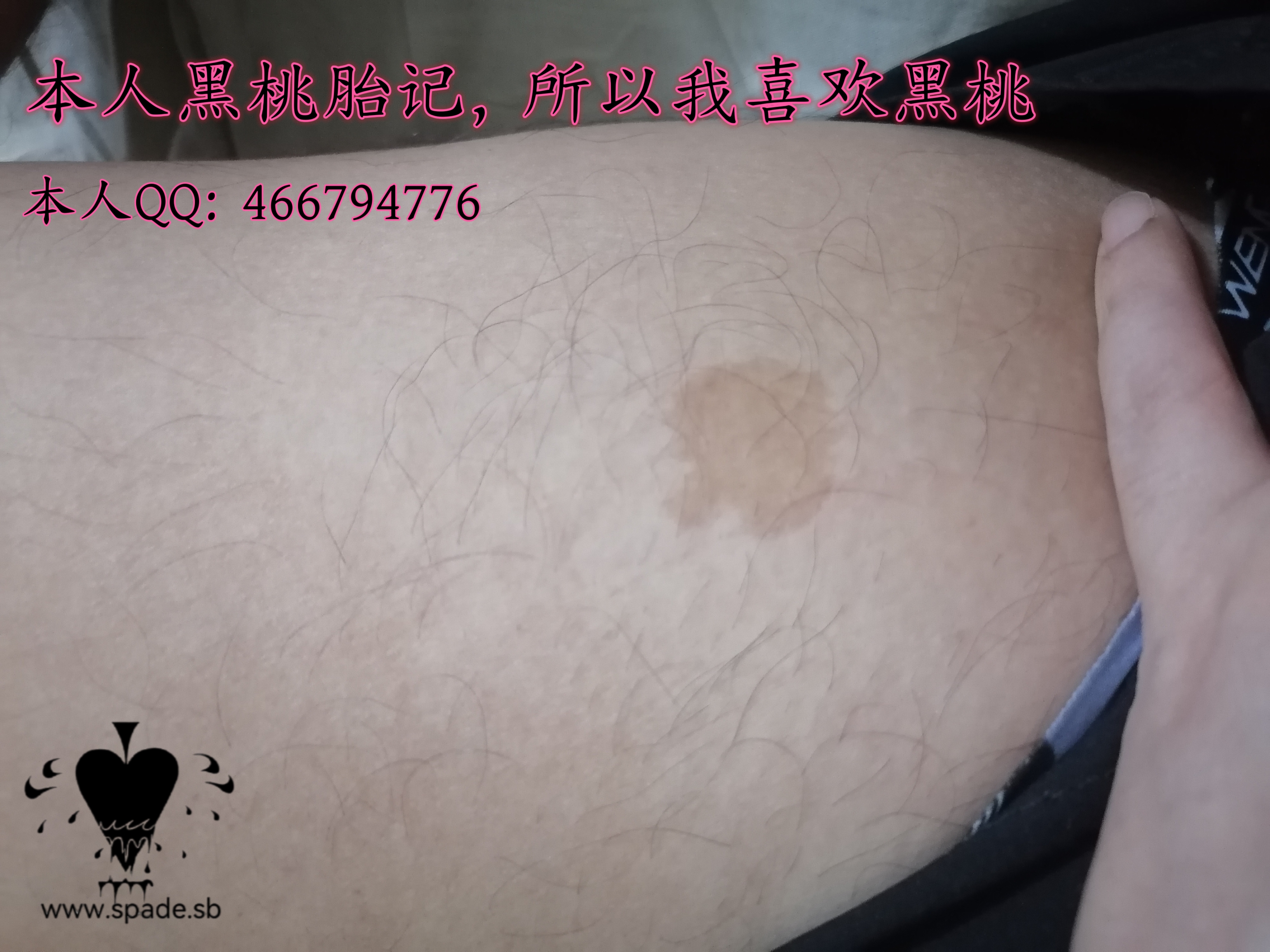 黑桃